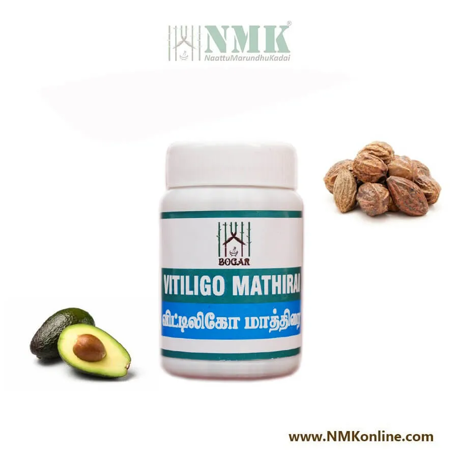 Vitiligo mathirai